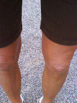 Kylknottriga ben...Och ja, ärret på knät är en löparskada. Spräckte det under ett träningsläger i Australien. Lagom kul men nu är det tack och lov bara ett... ärr :-)
